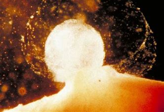 Πόνος ωορρηξίας